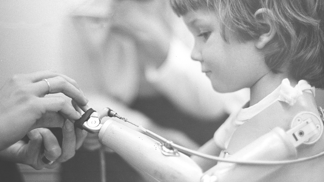 A child receives occupational therapy in 1976