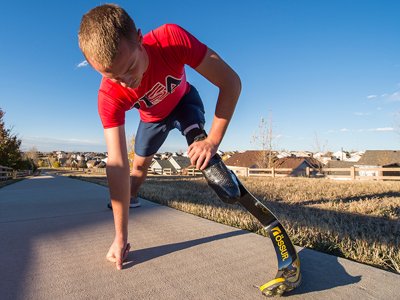 Garrison Hayes, wearing a prosthetic leg, gets ready to run on a trail in Colorado.