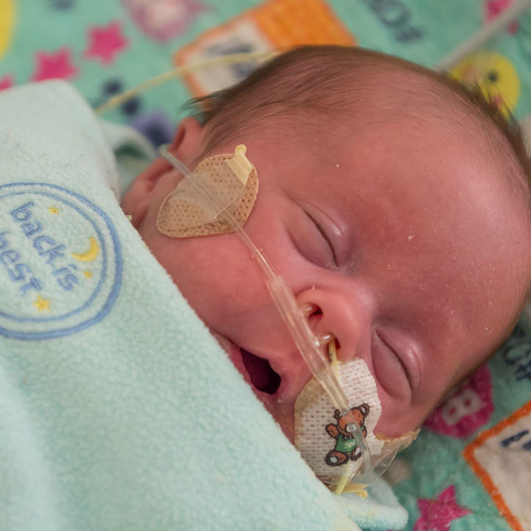 A baby in the NICU