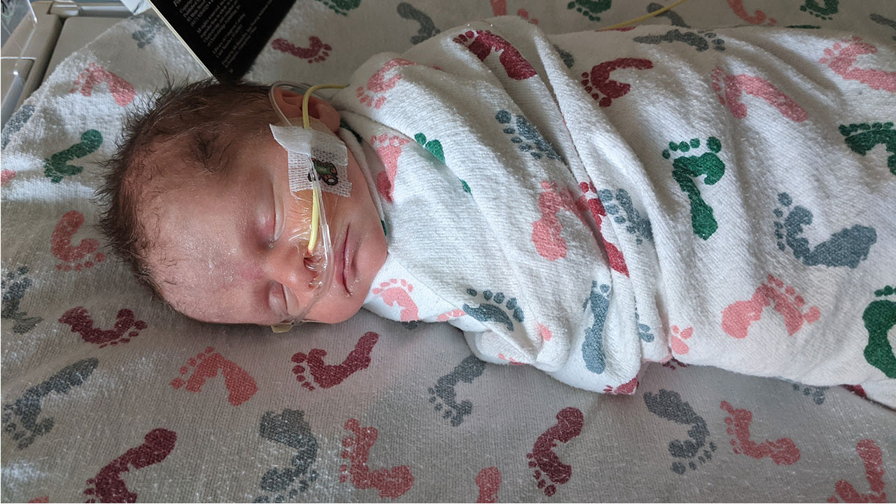 A baby girl with feeding and oxygen tubes sleeps while wrapped in a blanket with a baby footprint pattern.