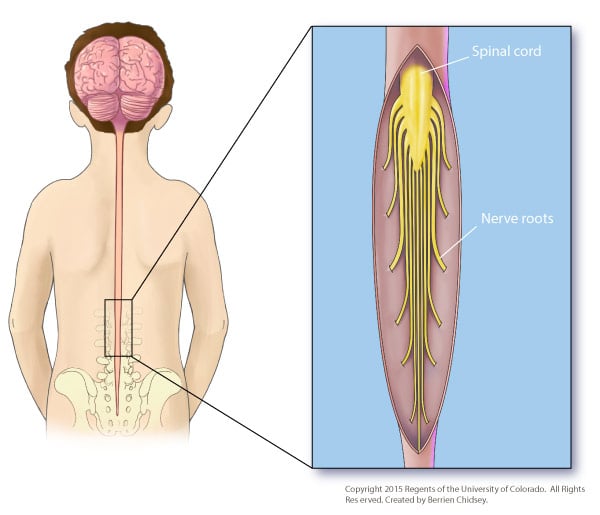 A graphic rendering of a child's back showing the spine and spinal cord, with a close-up of the spinal cord and nerve roots in a box to the side.