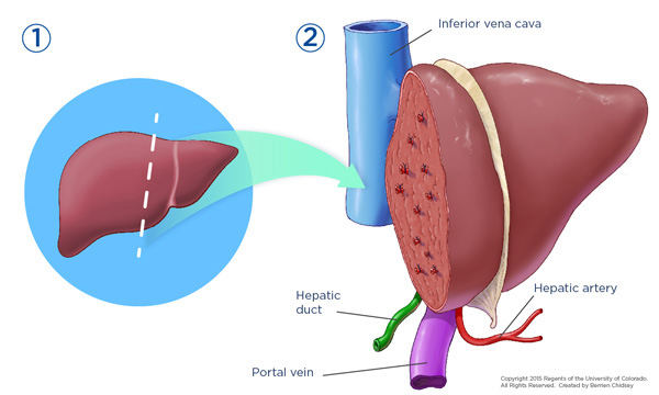 An illustration of a whole liver on a blue circle with a dashed white line through it and a blue arrow pointing to an illustration of the liver cut open with veins and arteries hanging out.