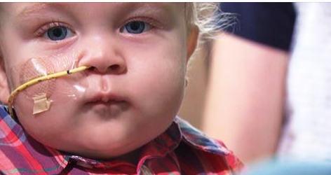 A close-up of a baby with a tube coming out of his nose.