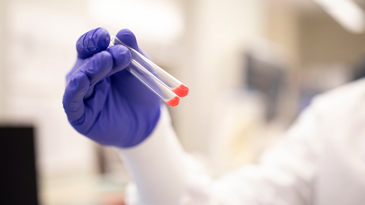 A gloved hand in a laboratory holds two test tubes that contain a small amount of blood.