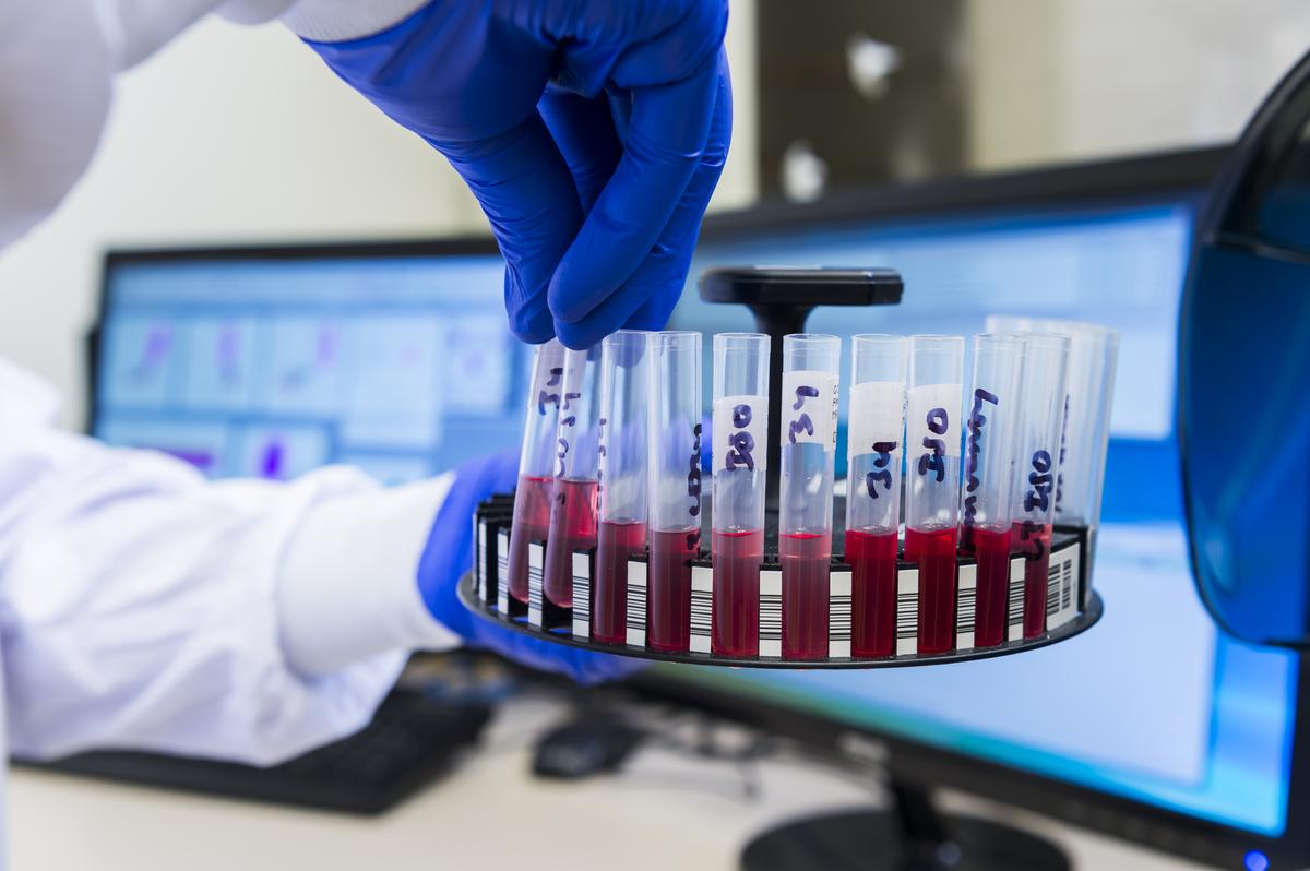 Blood samples in marked test tubes in a laboratory setting.