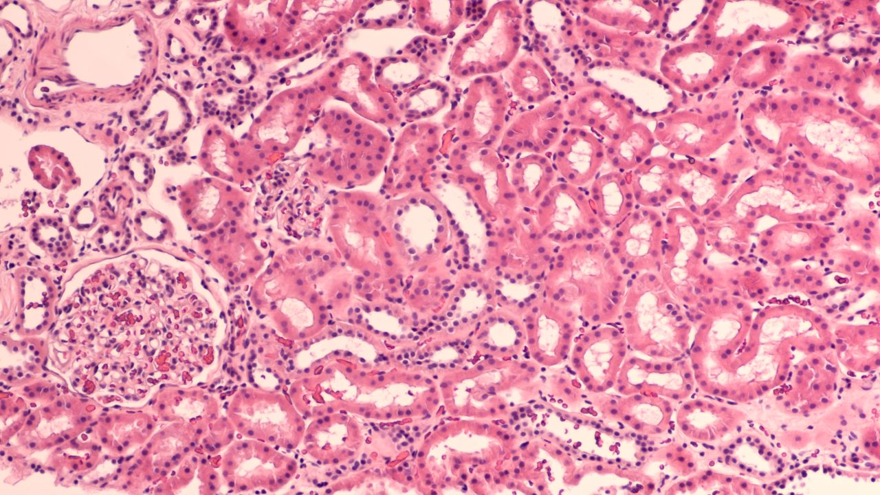 Photomicrograph of normal human kidney