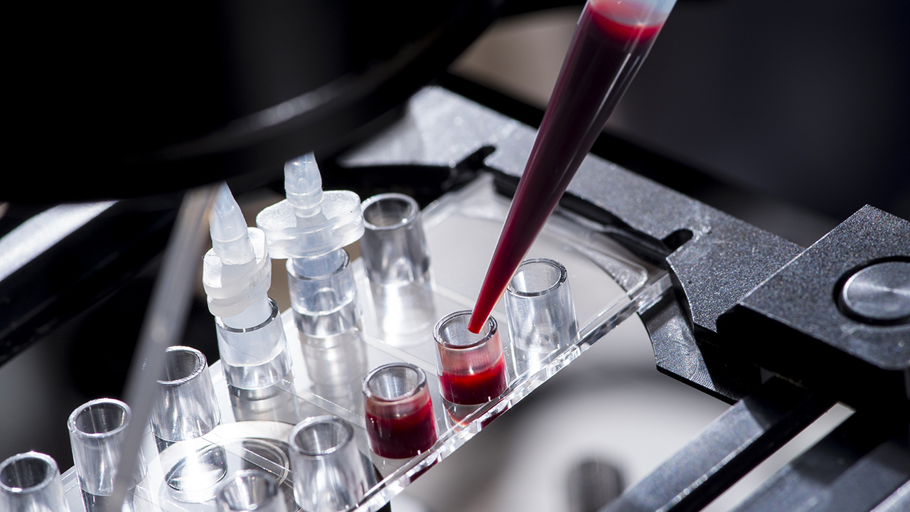 Blood samples in test tubes in a laboratory at Children’s Hospital Colorado.