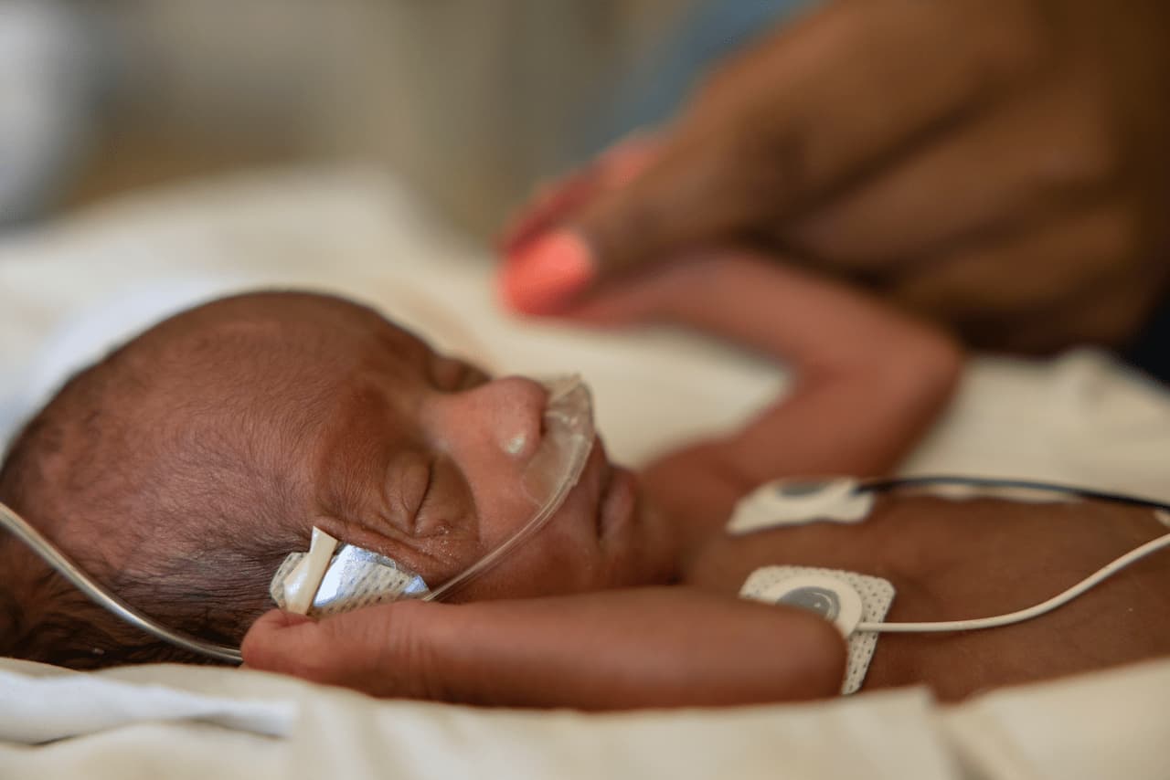 A preterm baby with a tubes coming from their nose and chest sleeps while an adult holds their hand.