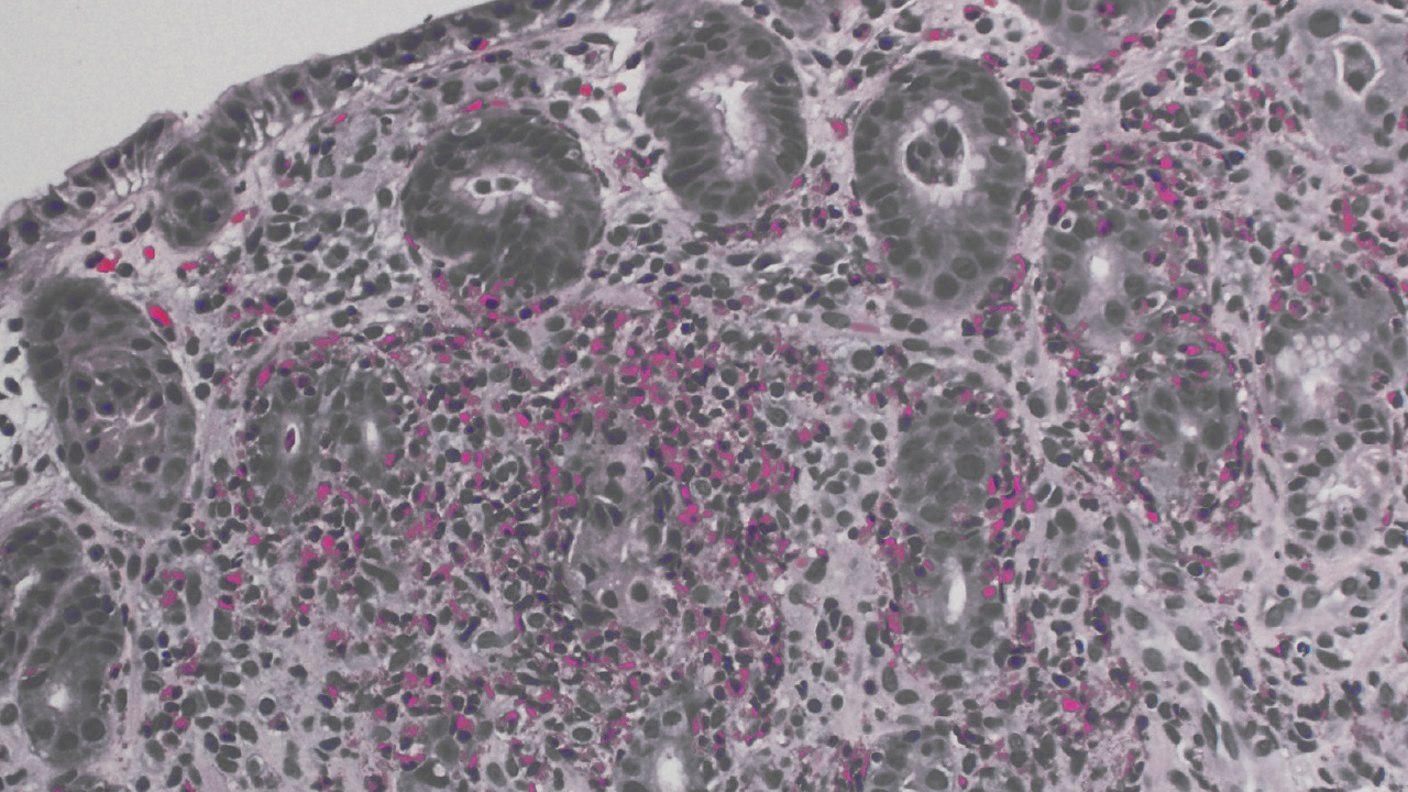  A microscopic image of gastrointestinal cells with some parts stained pink.