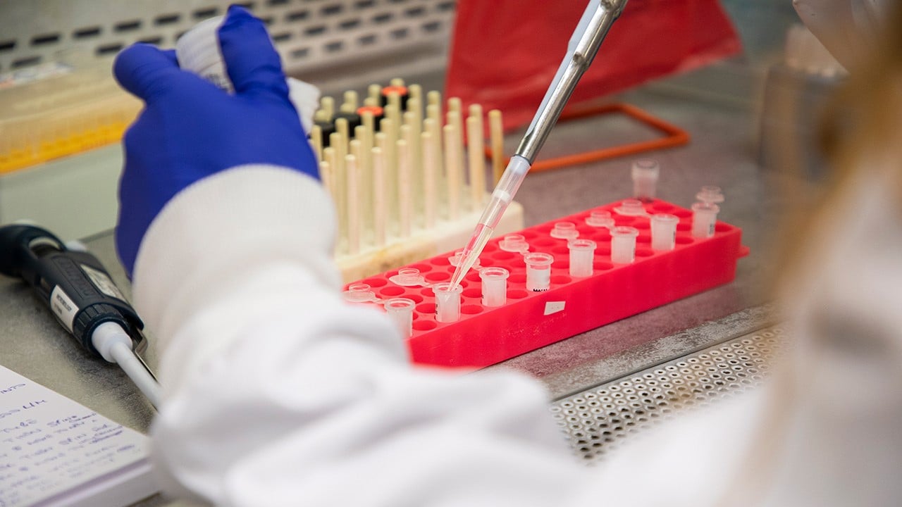 A person uses a pipette to put a clear substance in several small vials in a laboratory setting.