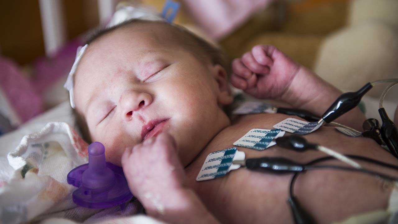 Infant with heart monitors