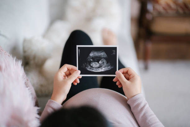 A pregnant woman looks at an image of an ultrasound