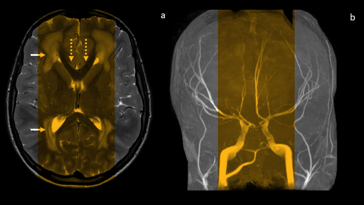 Image of brain scan