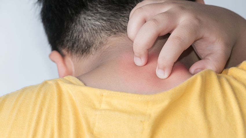 child scratching their irritated neck