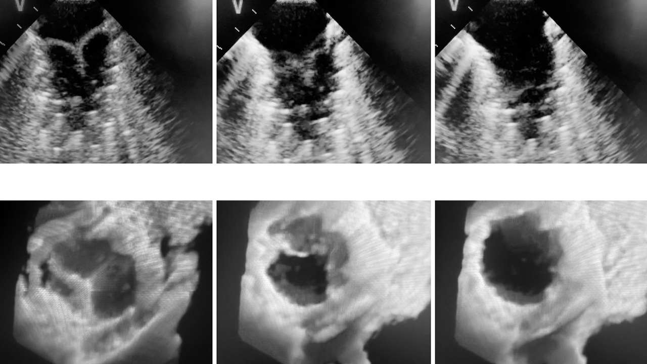 Grid of six ultrasound images