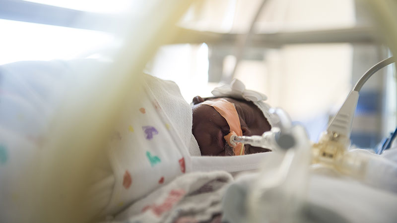 baby on ventilator